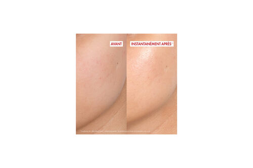 Liftactiv Collagen Specialist 16 Glow Boosting Gel - Liftactiv | L'Or&eacute;al Dermatological Beauty Partner Shop